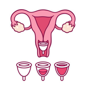 Menstrual cup use, feminine period hygiene product. Empty and full cup drawing with uterus and cervix diagram. Hand drawn cartoon style vector illustration.